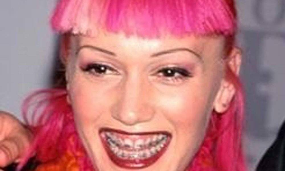 10. How Gwen Stefani's Blue Hair and Braces Inspired a Generation of Fans - wide 1