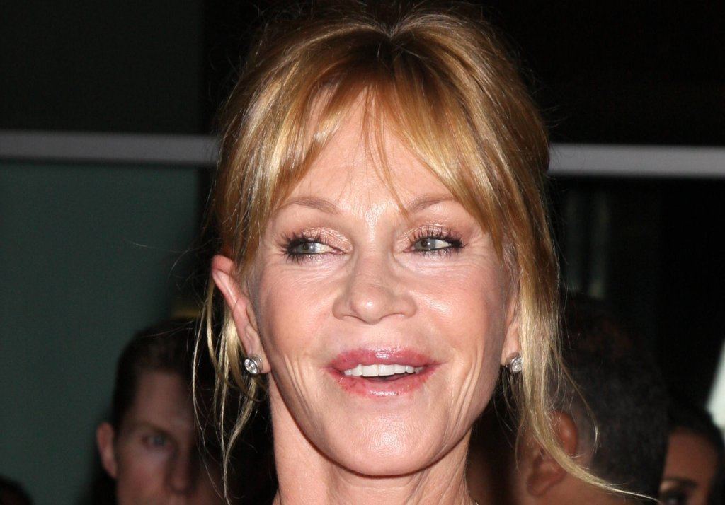 Melanie Griffith bad celebrity plastic surgery