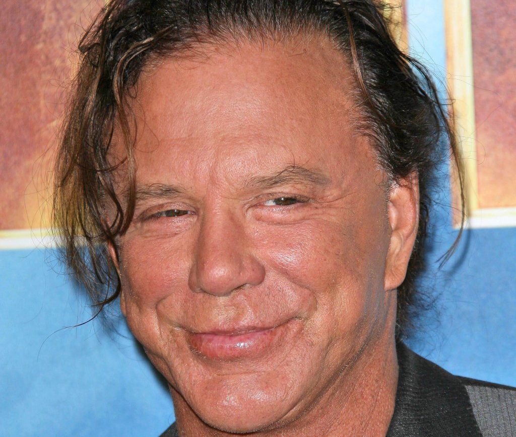 Mickey Rourke bad celebrity plastic surgery