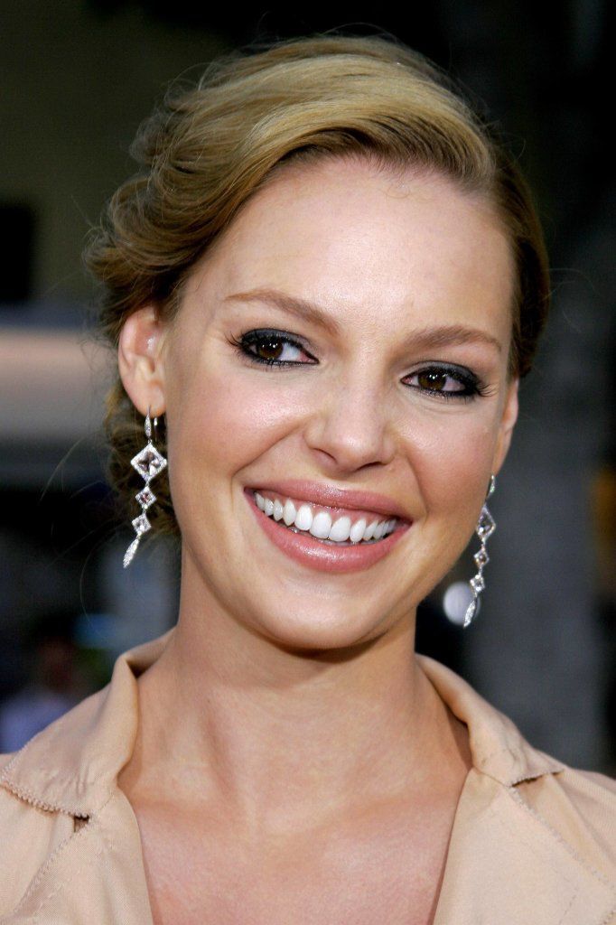 famous faces who wore adult braces