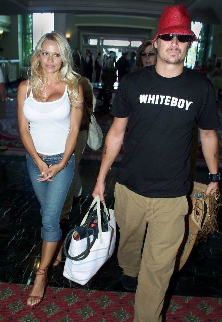 Pam Anderson and Kid Rock